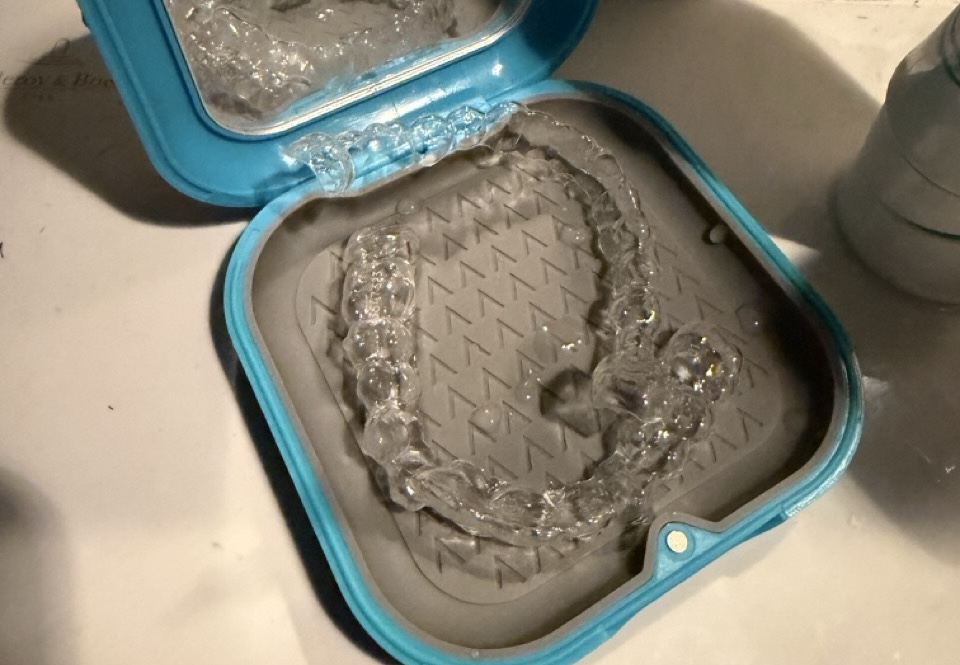 Why I choose clear aligners instead of metal braces?